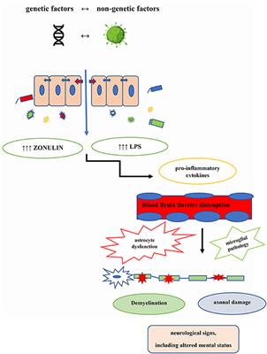 The Contribution of Gut Barrier Changes to Multiple Sclerosis Pathophysiology